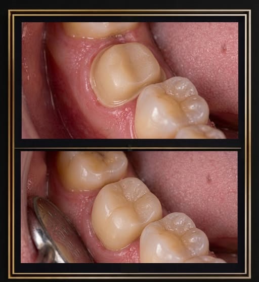 Dental treatment photo from The Dentalist Instagram