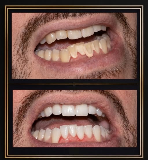 Dental treatment photo from The Dentalist Instagram