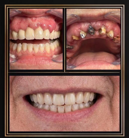 Dental treatment photo from The Dentalist Instagram