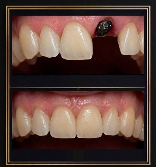 Dental treatment photo from The Dentalist Instagram